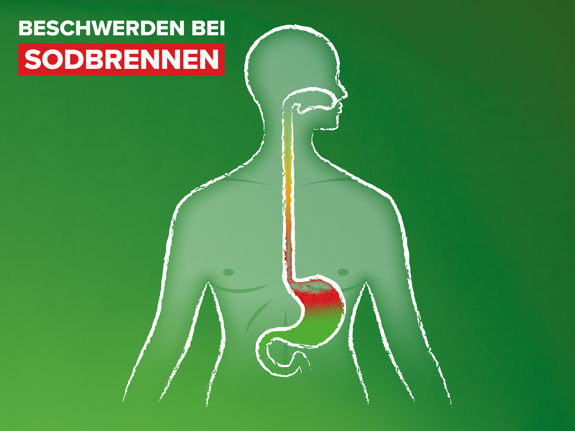 Illustration Beschwerden bei Sodbrennen