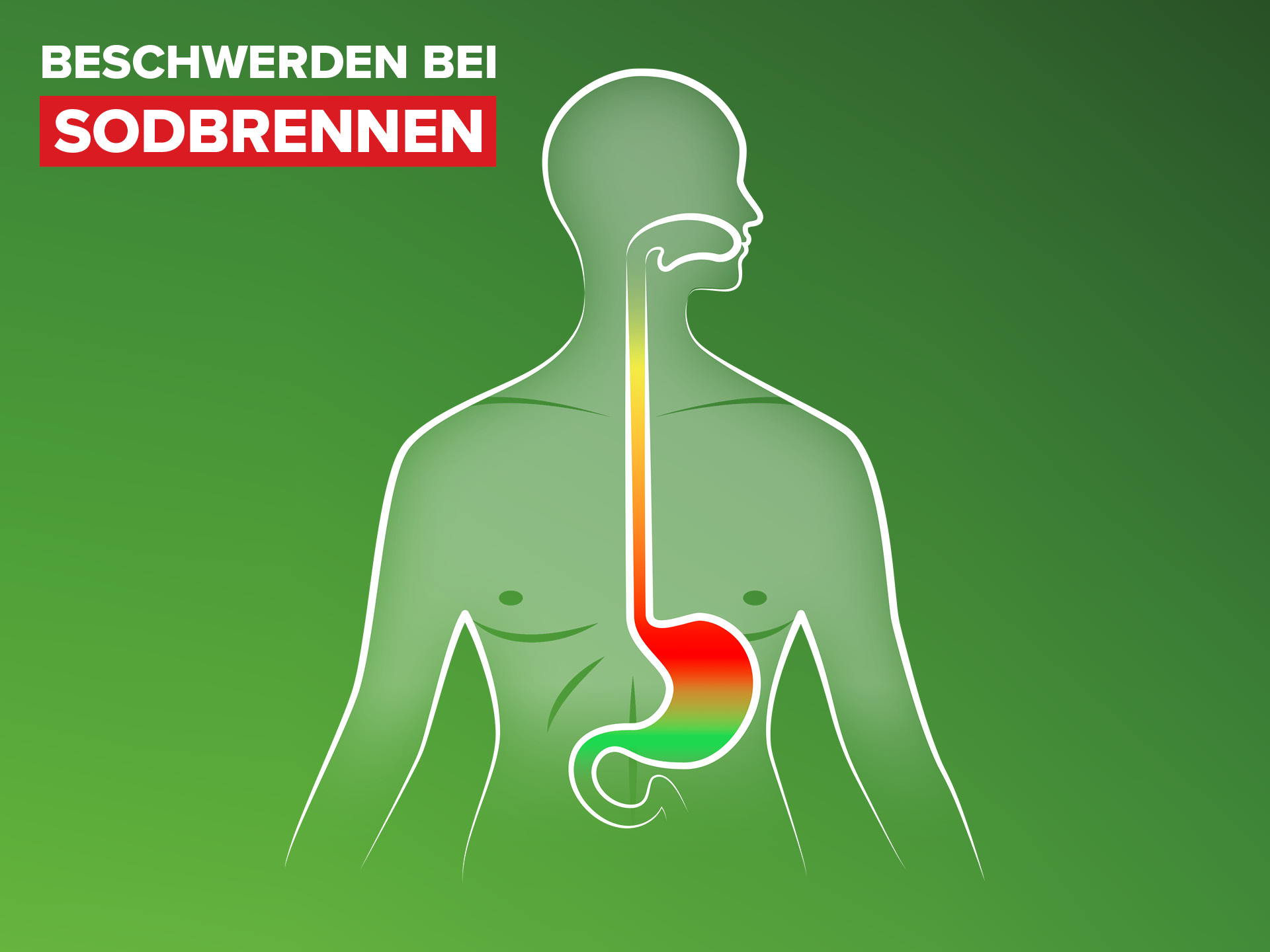 Illustration Beschwerden bei Sodbrennen